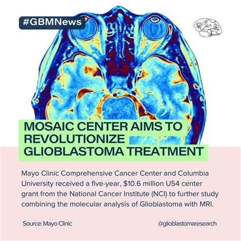 glioblastoma treatment centers